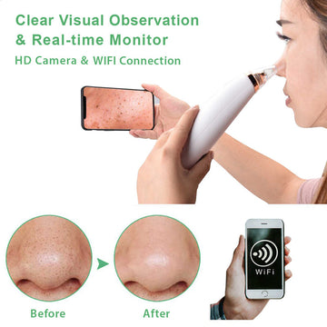 Visual Pore and Blackhead Cleaning Vacuum with Built in Camera